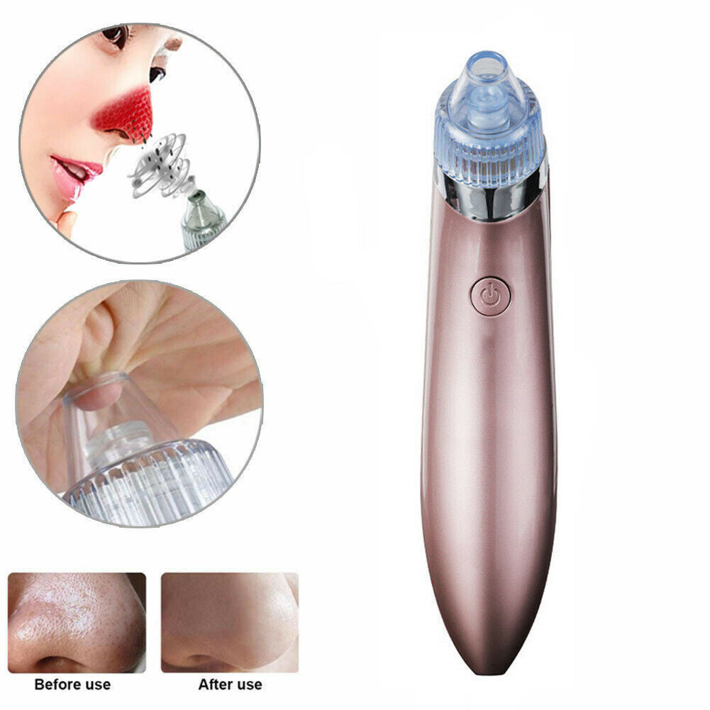 Electric Blackhead & Pore Vacuum Cleaner – Strong Suction Acne & Pimple Remover with Diamond Dermabrasion for Facial Skin Care