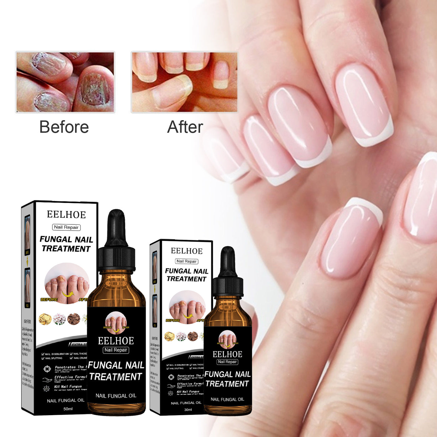 EELHOE Nail Repair & Care Solution – Strengthen, Brighten & Nourish Nails