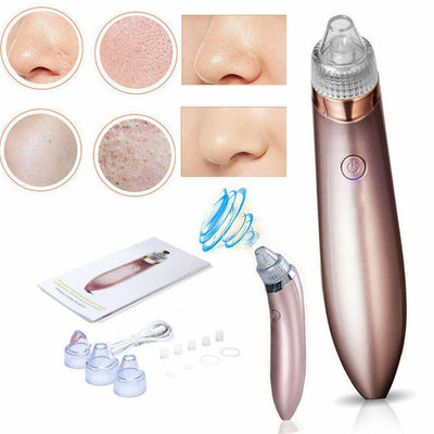 Electric Blackhead & Pore Vacuum Cleaner – Strong Suction Acne & Pimple Remover with Diamond Dermabrasion for Facial Skin Care